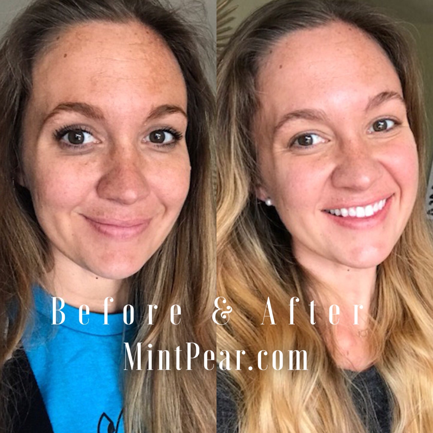 Serum Heaven Subscription Box!